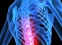 osteoporose